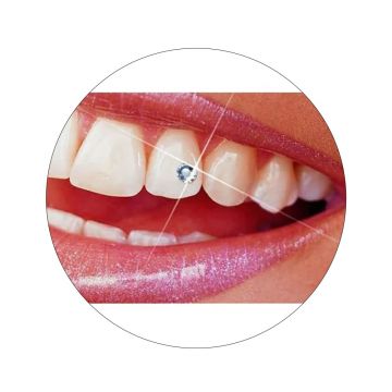 Bijuterii dentare Skyce Crystal Refill 1.8mm Ivoclar